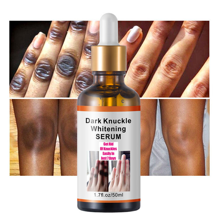 Élimine les zones sombres en 7 jours (sans irritation)