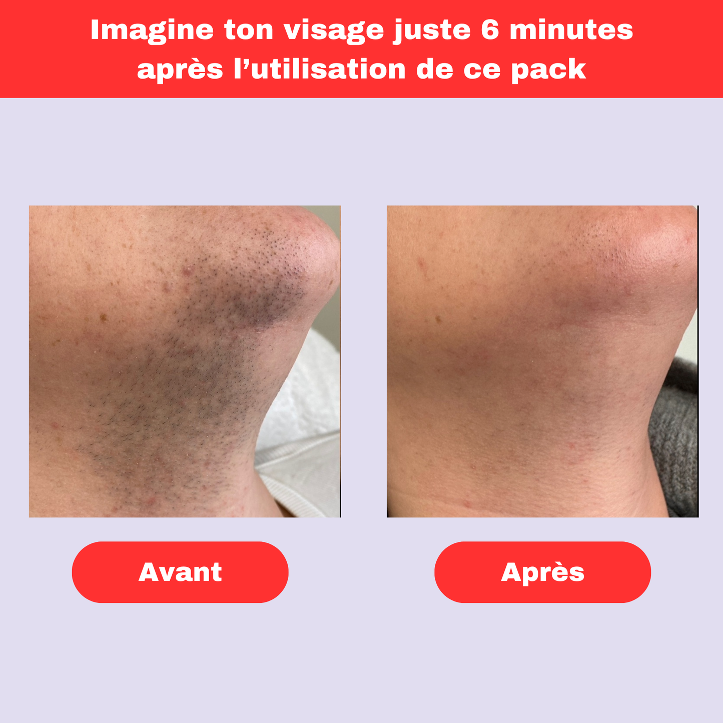 The Reyanne - Crème épilatoire faciale